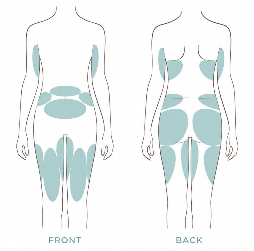 Illustration of the front and back of a woman's body highlighting fat cavitation treatment areas: arms, waist, tummy, hips, back, bum and thighs